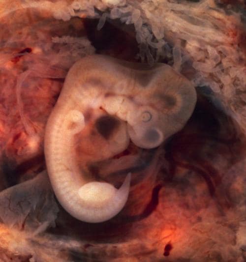 Thoughts and Questions About the Beginning of Life